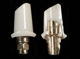 Implantatgetragene Versorgungen